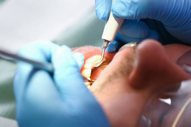 Best Dentist for Severe Toothache  in Conashaugh Lakes, PA