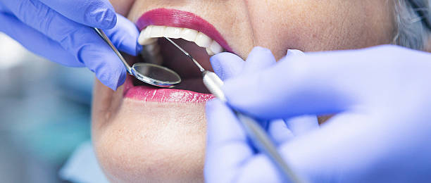 Best Teeth Whitening  in Conashaugh Lakes, PA
